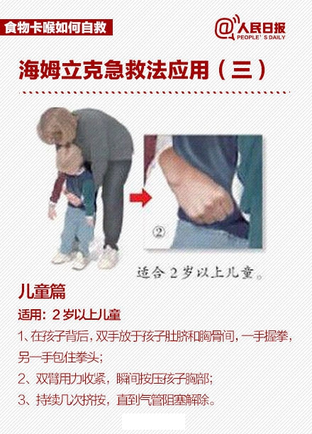 异物卡喉海姆立克急救法